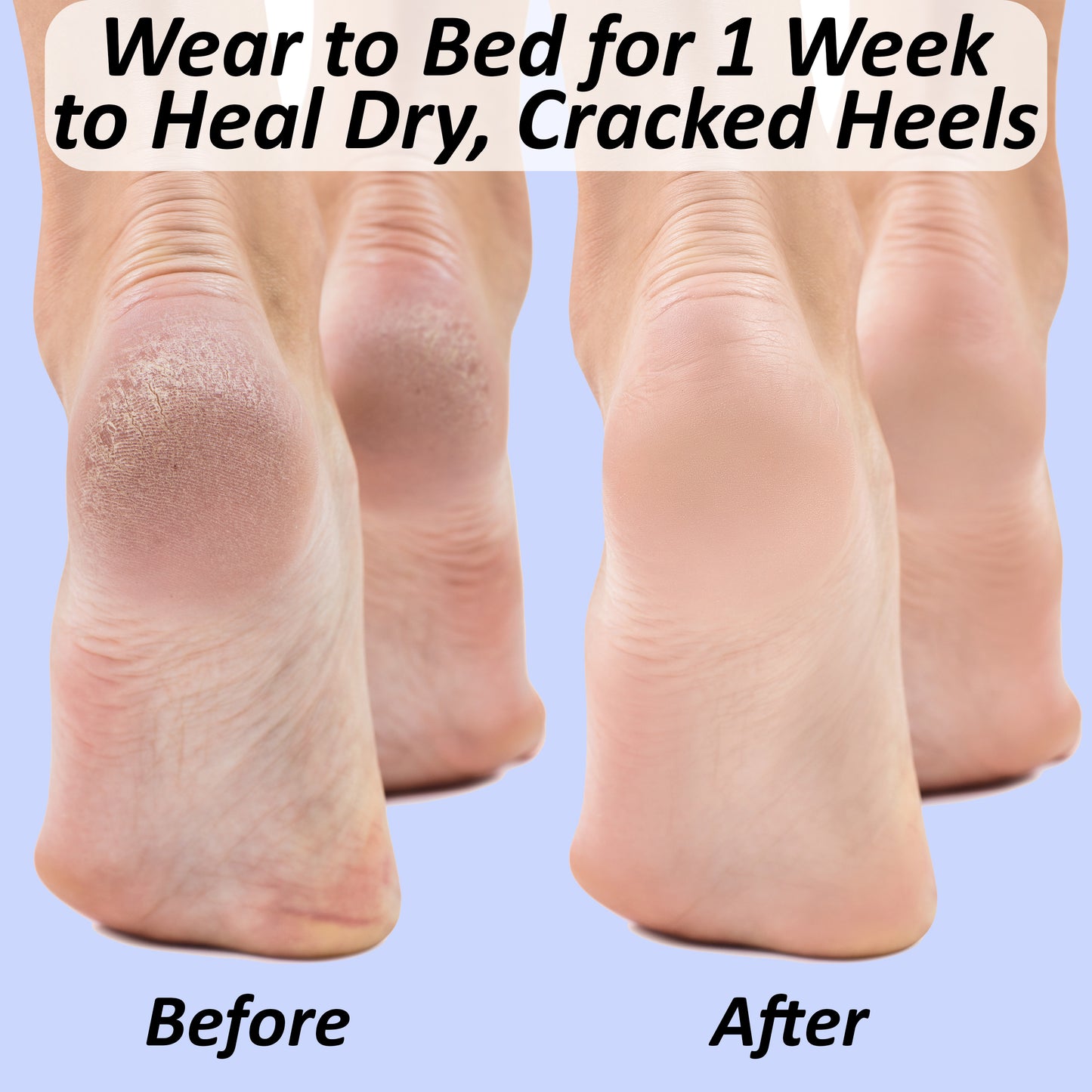 The Foot Medic 3 Pairs Moisturizing Socks, Hydrating Foot Cream and Foot File