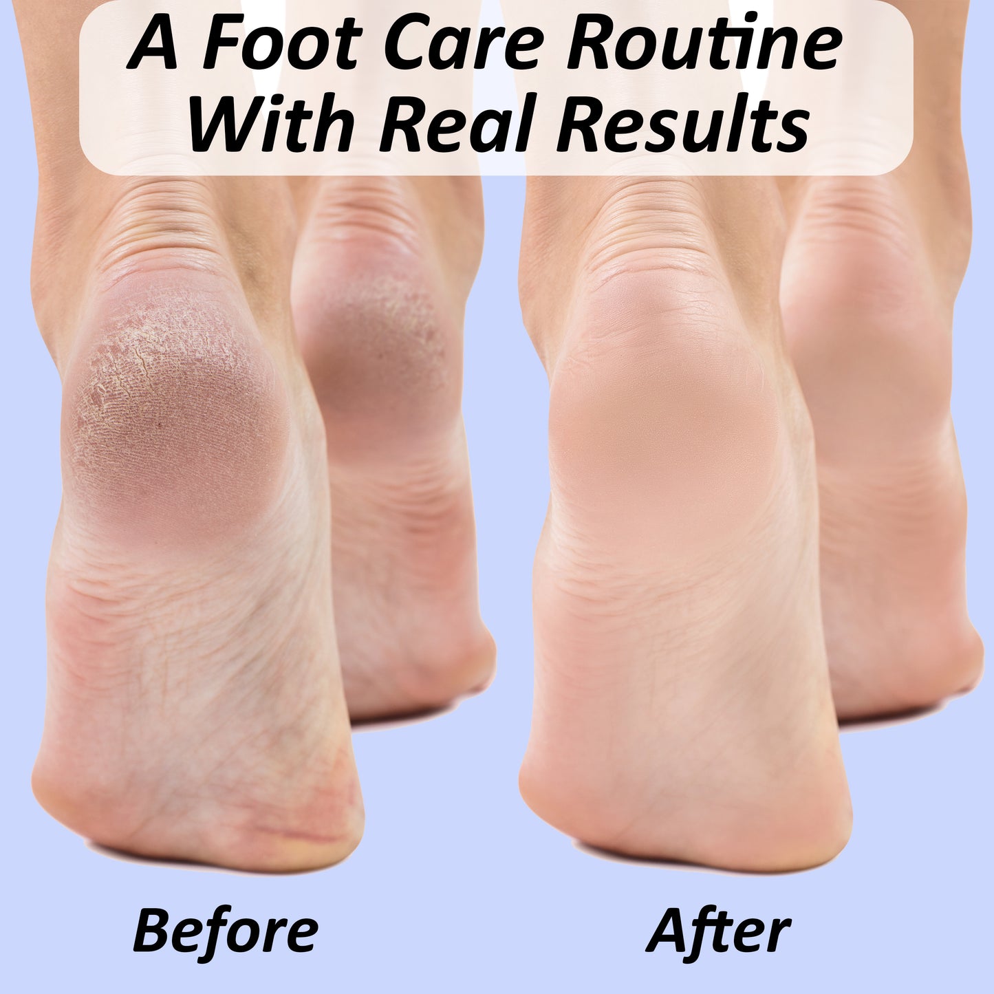 Sturdy Foot Bath Soaking Basin Tub Set: 16 oz Foot Soak, Foot File, Foot Cream, 2 Pumices, 2 Pairs Moisturizing Socks, Foot Care Gift